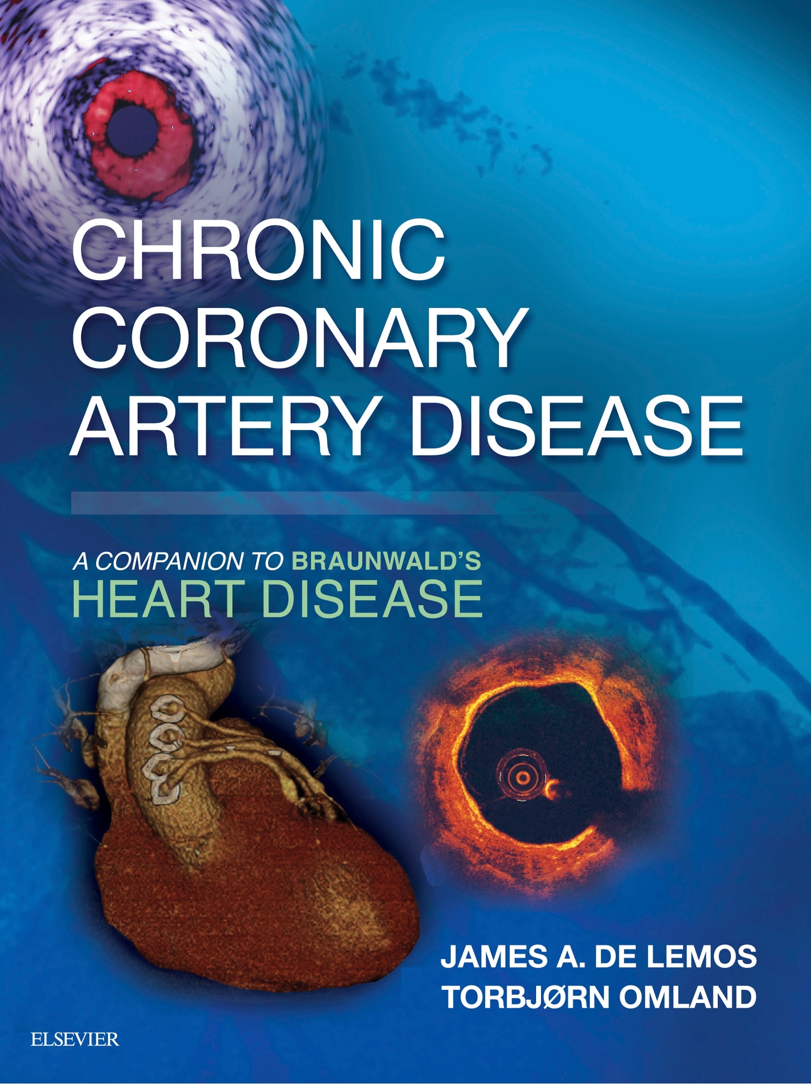 Chronic Coronary Artery Disease : a Companion to Braunwald’s Heart Disease