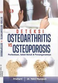 Deteksi Osteoarthritis vs Osteoporosis: Perbedaan, Seluk Beluk dan Penanganannya
