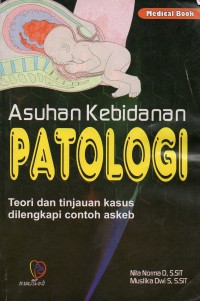 Asuhan Kebidanan: Patologi Teori dan Tinjauan Kasus