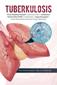 Tuberkulosis